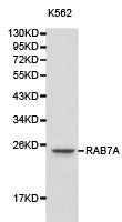 Western blot analysis of K562 cell lysate using RAB7A antibody.