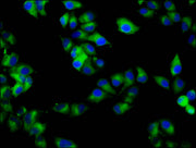 Immunofluorescence staining of Hela cells with CSB-PA019220LA01HU at 1:133, counter-stained with DAPI. The cells were fixed in 4% formaldehyde, permeabilized using 0.2% Triton X-100 and blocked in 10% normal Goat Serum. The cells were then incubat...