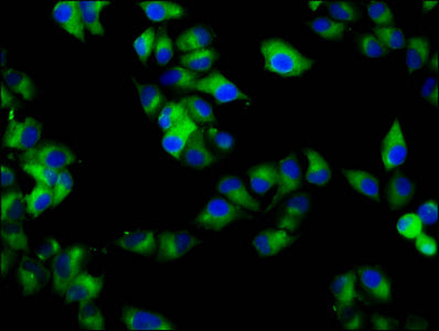 Immunofluorescence staining of Hela cells with CSB-PA019220LA01HU at 1:133, counter-stained with DAPI. The cells were fixed in 4% formaldehyde, permeabilized using 0.2% Triton X-100 and blocked in 10% normal Goat Serum. The cells were then incubat...