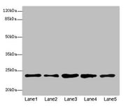 Western blot All lanes: RAB9A antibody at 7.66µg/ml Lane 1: Jurkat whole cell lysate Lane 2: K562 whole cell lysate Lane 3: HepG2 whole cell lysate Lane 4: 293T whole cell lysate Lane 5: Hela whole cell lysate Secondary Goat polyclonal to rabbit I...