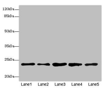 Western blot All lanes: RAB9A antibody at 7.66µg/ml Lane 1: Jurkat whole cell lysate Lane 2: K562 whole cell lysate Lane 3: HepG2 whole cell lysate Lane 4: 293T whole cell lysate Lane 5: Hela whole cell lysate Secondary Goat polyclonal to rabbit I...