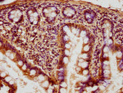 IHC image of CSB-PA019235HA01HU diluted at 1:400 and staining in paraffin-embedded human small intestine tissue performed on a Leica BondTM system. After dewaxing and hydration, antigen retrieval was mediated by high pressure in a citrate buffer (...
