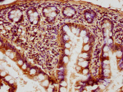IHC image of CSB-PA019235HA01HU diluted at 1:400 and staining in paraffin-embedded human small intestine tissue performed on a Leica BondTM system. After dewaxing and hydration, antigen retrieval was mediated by high pressure in a citrate buffer (...