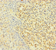 Immunohistochemistry of paraffin-embedded human tonsil tissue using CSB-PA019248LA01HU at dilution of 1:100