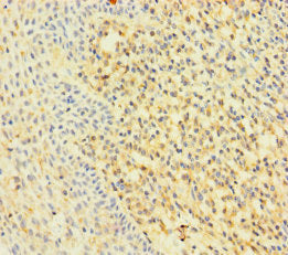 Immunohistochemistry of paraffin-embedded human tonsil tissue using CSB-PA019248LA01HU at dilution of 1:100