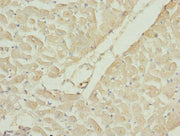 Immunohistochemistry of paraffin-embedded human heart tissue using CSB-PA019249ESR1HU at dilution of 1:100