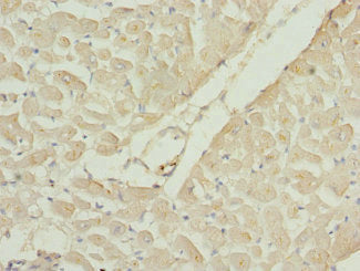 Immunohistochemistry of paraffin-embedded human heart tissue using CSB-PA019249ESR1HU at dilution of 1:100