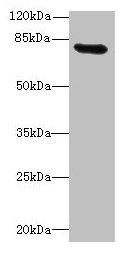 Western blot All lanes: RAD17 antibody at 12µg/ml + Mouse thymus tissue Secondary Goat polyclonal to rabbit IgG at 1/10000 dilution Predicted band size: 78, 76, 58, 67 kDa Observed band size: 78 kDa