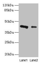 Western blot All lanes: RAD23B antibody at 2µg/ml Lane 1: 293T whole cell lysate Lane 2: MCF-7 whole cell lysate Secondary Goat polyclonal to rabbit IgG at 1/10000 dilution Predicted band size: 44, 36 kDa Observed band size: 44 kDa