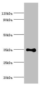 Western blot All lanes: DNA repair protein RAD51 homolog 4 antibody at 8ug/ml + Jurkat whole cell lysate Secondary Goat polyclonal to rabbit IgG at 1/10000 dilution Predicted band size: 36, 6, 24, 31, 13, 23, 38 kDa Observed band size: 36 kDa