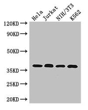 Western Blot Positive WB detected in: Hela whole cell lysate, Jurkat whole cell lysate, NIH/3T3 whole cell lysate, K562 whole cell lysate All lanes: RAD51 antibody at 2.7µg/ml Secondary Goat polyclonal to rabbit IgG at 1/50000 dilution Predicted b...
