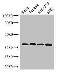 Western Blot Positive WB detected in: Hela whole cell lysate, Jurkat whole cell lysate, NIH/3T3 whole cell lysate, K562 whole cell lysate All lanes: RAD51 antibody at 2.7µg/ml Secondary Goat polyclonal to rabbit IgG at 1/50000 dilution Predicted b...