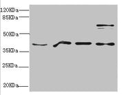 Western blot All lanes: RAE1 antibody at 4.39ug/ml Lane 1: Mouse brain tissue Lane 2: HepG2 whole cell lysate Lane 3: 293T whole cell lysate Lane 4: Hela whole cell lysate Secondary Goat polyclonal to rabbit IgG at 1/10000 dilution Predicted band...
