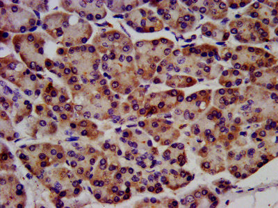 IHC image of CSB-PA019284LA01HU diluted at 1:1200 and staining in paraffin-embedded human pancreatic tissue performed on a Leica BondTM system. After dewaxing and hydration, antigen retrieval was mediated by high pressure in a citrate buffer (pH 6...