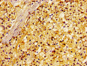 Immunohistochemistry of paraffin-embedded human adrenal gland tissue using CSB-PA019296LA01HU at dilution of 1:100