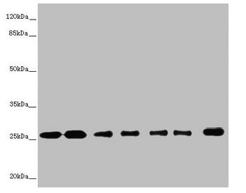 Western blot All lanes: RALB antibody at 1.26µg/ml Lane 1: Mouse brain tissue Lane 2: Mouse lung tissue Lane 3: MCF-7 whole cell lysate Lane 4: HepG2 whole cell lysate Lane 5: Jurkat whole cell lysate Lane 6: NIH/3T3 whole cell lysate Lane 7: Hela...