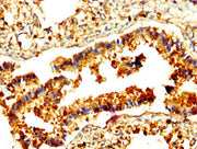 IHC image of CSB-PA019305LA01HU diluted at 1:500 and staining in paraffin-embedded human lung tissue performed on a Leica BondTM system. After dewaxing and hydration, antigen retrieval was mediated by high pressure in a citrate buffer (pH 6.0). Se...
