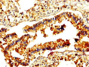IHC image of CSB-PA019305LA01HU diluted at 1:500 and staining in paraffin-embedded human lung tissue performed on a Leica BondTM system. After dewaxing and hydration, antigen retrieval was mediated by high pressure in a citrate buffer (pH 6.0). Se...