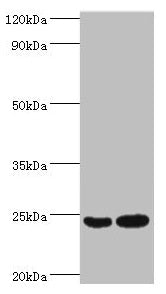 Western blot All lanes: RAN antibody at 2µg/ml Lane 1: Hela whole cell lysate Lane 2: Jurkat whole cell lysate Secondary Goat polyclonal to rabbit IgG at 1/10000 dilution Predicted band size: 24 kDa Observed band size: 24 kDa