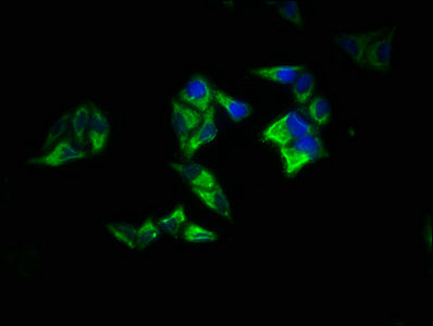 Immunofluorescence staining of Hela cells with CSB-PA019321LA01HU at 1:200, counter-stained with DAPI. The cells were fixed in 4% formaldehyde, permeabilized using 0.2% Triton X-100 and blocked in 10% normal Goat Serum. The cells were then incubat...