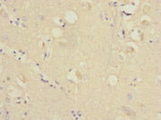 Immunohistochemistry of paraffin-embedded human brain tissue using CSB-PA019327ESR2HU at dilution of 1:100