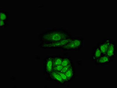 Immunofluorescent analysis of HepG2 cells using CSB-PA019339LA01HU at dilution of 1:100 and Alexa Fluor 488-congugated AffiniPure Goat Anti-Rabbit IgG(H+L)