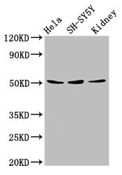 Western Blot Positive WB detected in: Hela whole cell lysate, SH-SY5Y whole cell lysate, Mouse kidney tissue All lanes: RARG antibody at 8µg/ml Secondary Goat polyclonal to rabbit IgG at 1/50000 dilution Predicted band size: 51, 50, 43, 48 kDa Obs...