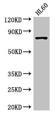 Western Blot Positive WB detected in: HL60 whole cell lysate All lanes: RARS antibody at 3.5µg/ml Secondary Goat polyclonal to rabbit IgG at 1/50000 dilution Predicted band size: 76, 68 kDa Observed band size: 76 kDa