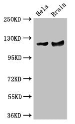 Western Blot Positive WB detected in: Hela whole cell lysate, Mouse brain tissue All lanes: RASA1 antibody at 3.5µg/ml Secondary Goat polyclonal to rabbit IgG at 1/50000 dilution Predicted band size: 117, 101, 59, 102 kDa Observed band size: 117 kDa