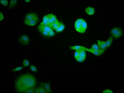 Immunofluorescence staining of MCF-7 cells with CSB-PA019351LA01HU at 1:105, counter-stained with DAPI. The cells were fixed in 4% formaldehyde, permeabilized using 0.2% Triton X-100 and blocked in 10% normal Goat Serum. The cells were then incuba...