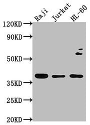 Western Blot Positive WB detected in: Raji whole cell lysate, Jurkat whole cell lysate, HL-60 whole cell lysate All lanes: RASSF2 antibody at 1:2000 Secondary Goat polyclonal to rabbit IgG at 1/50000 dilution Predicted band size: 38, 18 kDa Observ...
