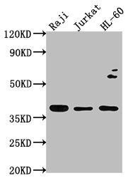 Western Blot Positive WB detected in: Raji whole cell lysate, Jurkat whole cell lysate, HL-60 whole cell lysate All lanes: RASSF2 antibody at 1:2000 Secondary Goat polyclonal to rabbit IgG at 1/50000 dilution Predicted band size: 38, 18 kDa Observ...