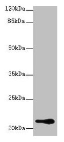 Western blot All lanes: RBBP9 antibody at 1µg/ml + A375 whole cell lysate Secondary Goat polyclonal to rabbit IgG at 1/10000 dilution Predicted band size: 21, 20 kDa Observed band size: 21 kDa