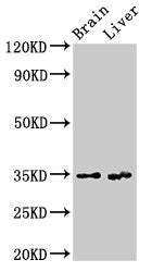 Western Blot Positive WB detected in: Rat brain tissue, Rat liver tissue All lanes: RBKS antibody at 3.4µg/ml Secondary Goat polyclonal to rabbit IgG at 1/50000 dilution Predicted band size: 35, 31 kDa Observed band size: 35 kDa
