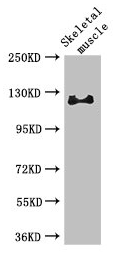 Western Blot Positive WB detected in: Mouse skeletal muscle tissue All lanes: RBL1 antibody at 3µg/ml Secondary Goat polyclonal to rabbit IgG at 1/50000 dilution Predicted band size: 121, 115 kDa Observed band size: 121 kDa