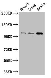 Western Blot Positive WB detected in: Mouse heart tissue, Mouse lung tissue, Mouse brain tissue All lanes: RBM10 antibody at 3µg/ml Secondary Goat polyclonal to rabbit IgG at 1/50000 dilution Predicted band size: 104, 95, 111 kDa Observed band siz...