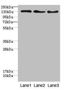 Western blot All lanes: RBP2antibody at 1.76ug/ml Lane 1: Hela whole cell lysate Lane 2: HepG2 whole cell lysate Lane 3: Jurkat whole cell lysate Secondary Goat polyclonal to rabbit IgG at 1/10000 dilution Predicted band size: 192 kDa Observed ban...