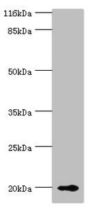 Western blot All lanes: RBP5 antibody at 8µg/ml + Mouse liver tissue Secondary Goat polyclonal to rabbit IgG at 1/10000 dilution Predicted band size: 16 kDa Observed band size: 20 kDa