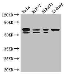 Western Blot Positive WB detected in: Hela whole cell lysate, MCF-7 whole cell lysate, HEK293 whole cell lysate, Mouse kidney tissue All lanes: RBPJ antibody at 3.5ug/ml Secondary Goat polyclonal to rabbit IgG at 1/50000 dilution Predicted band si...