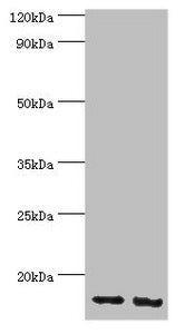 Western blot All lanes: E3 ubiquitin-protein ligase RBX1 antibody at 4ug/ml Lane 1: Hela whole cell lysate Lane 2: HepG2 whole cell lysate Secondary Goat polyclonal to rabbit IgG at 1/10000 dilution Predicted band size: 12 kDa Observed band size:...