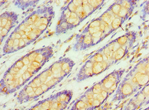 Immunohistochemistry of paraffin-embedded human colon tissue using CSB-PA019496ESR2HU at dilution of 1:100