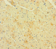 Immunohistochemistry of paraffin-embedded human heart tissue using CSB-PA019500LA01HU at dilution of 1:100