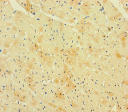 Immunohistochemistry of paraffin-embedded human heart tissue using CSB-PA019500LA01HU at dilution of 1:100