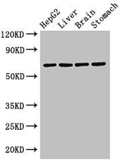 Western Blot Positive WB detected in: HepG2 whole cell lysate, Rat liver tissue, Rat brain tissue, Rat stomach tissue All lanes: RCBTB2 antibody at 3.2µg/ml Secondary Goat polyclonal to rabbit IgG at 1/50000 dilution Predicted band size: 61, 58 kD...