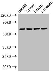 Western Blot Positive WB detected in: HepG2 whole cell lysate, Rat liver tissue, Rat brain tissue, Rat stomach tissue All lanes: RCBTB2 antibody at 3.2µg/ml Secondary Goat polyclonal to rabbit IgG at 1/50000 dilution Predicted band size: 61, 58 kD...
