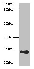Western blot All lanes: RCVRN antibody at 2µg/ml + Mouse eye tissue Secondary Goat polyclonal to rabbit IgG at 1/10000 dilution Predicted band size: 24 kDa Observed band size: 24 kDa