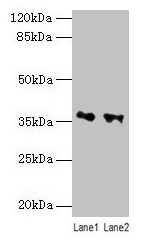 Western blot All lanes: RDH11 antibody at 10µg/ml Lane 1: PC-3 whole cell lysate Lane 2: Hela whole cell lysate Secondary Goat polyclonal to rabbit IgG at 1/10000 dilution Predicted band size: 36, 35, 28 kDa Observed band size: 36 kDa