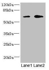 Western blot All lanes: REC8 antibody at 1.67µg/ml Lane 1: Jurkat whole cell lysate Lane 2: HT29 whole cell lysate Secondary Goat polyclonal to rabbit IgG at 1/10000 dilution Predicted band size: 63, 61 kDa Observed band size: 63 kDa