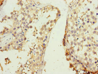 Immunohistochemistry of paraffin-embedded human testis tissue using CSB-PA019535ESR2HU at dilution of 1:100