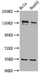 Western Blot Positive WB detected in: Hela whole cell lysate, HepG2 whole cell lysate All lanes: RECQL4 antibody at 4.8µg/ml Secondary Goat polyclonal to rabbit IgG at 1/50000 dilution Predicted band size: 134 kDa Observed band size: 134 kDa